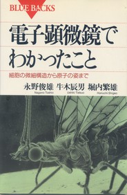 電子顕微鏡でわかったこと